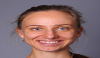 מ. ברטל